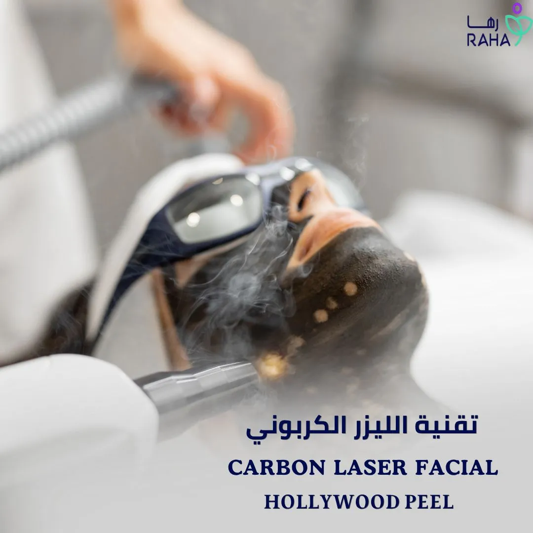 &nbsp;تقنية الليزر الكربوني (Carbon Laser Facial)